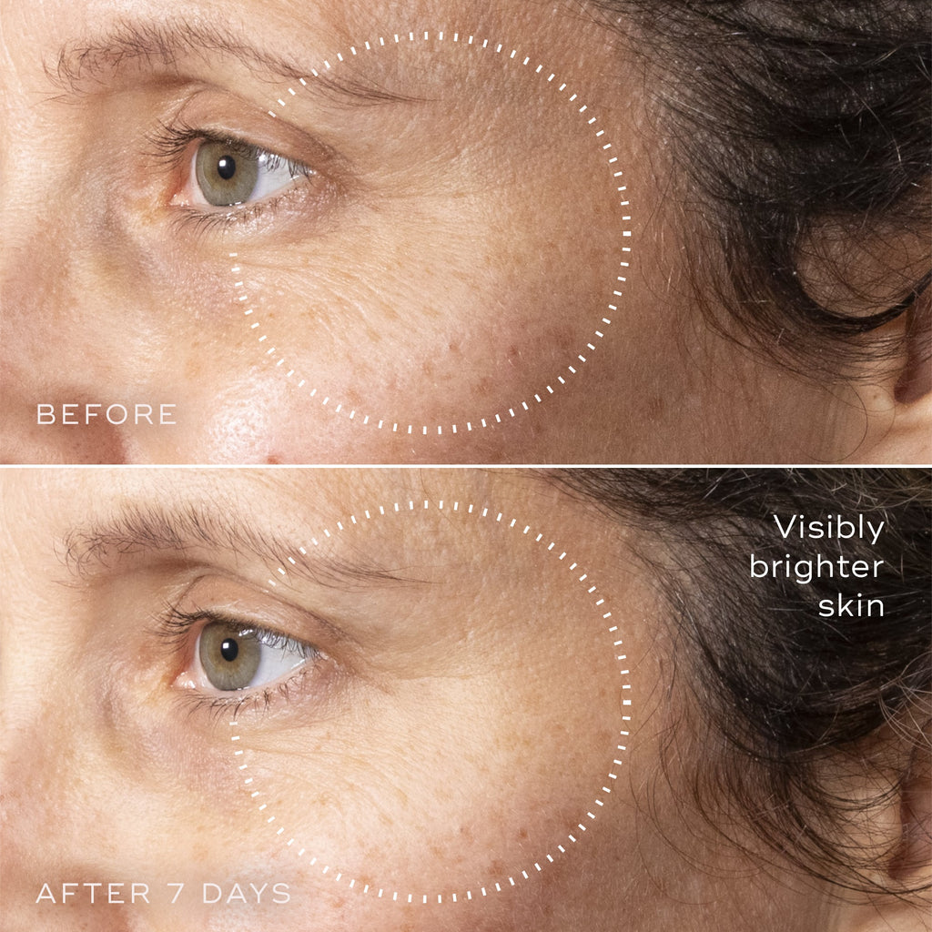 C-Tetra™ Advanced Gel-Serum
