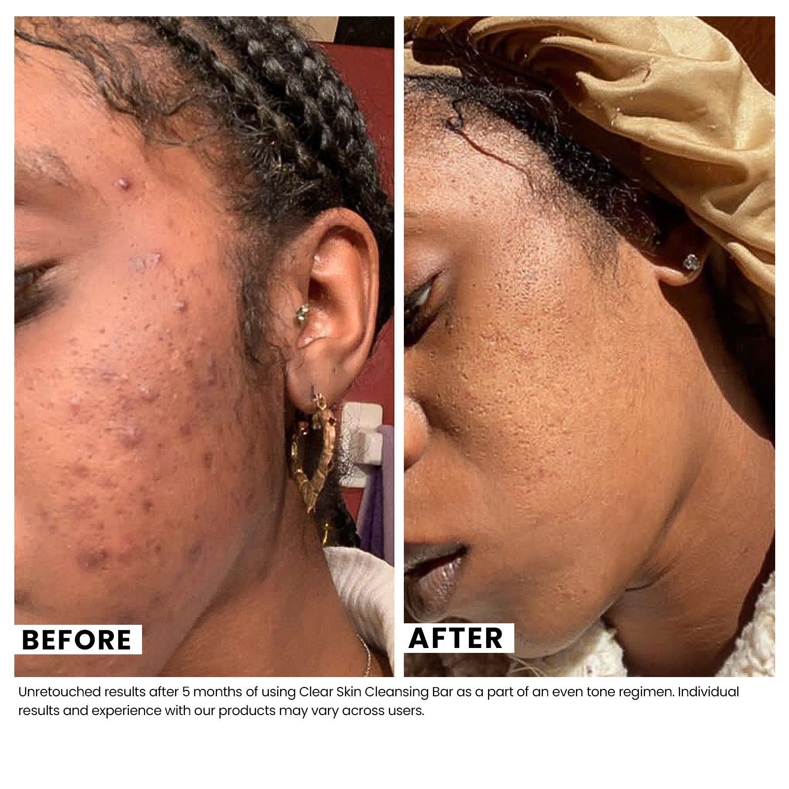 Clear Skin Cleansing Bar