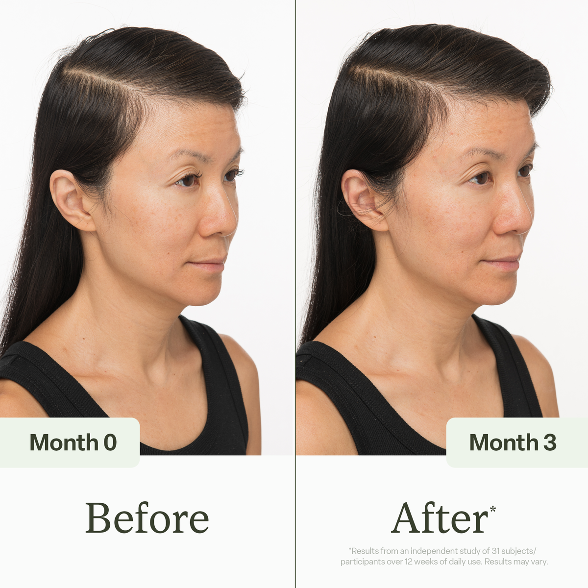 100ml Scalp Serum