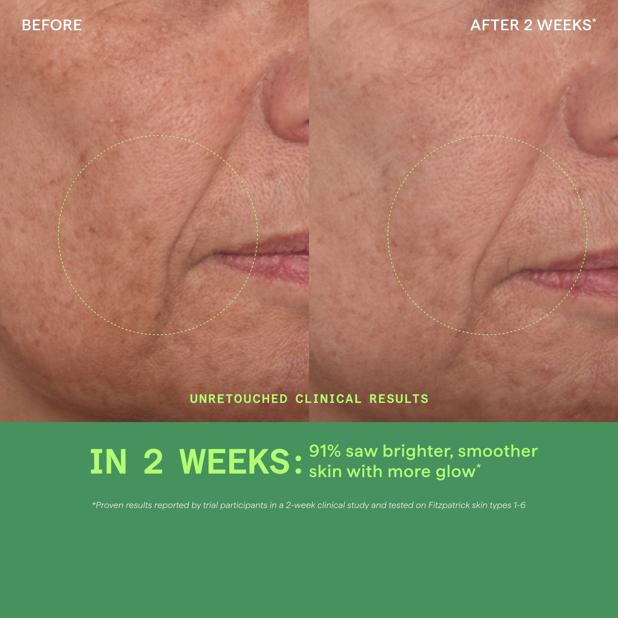 Vita-C Glycolic Serum