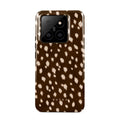 Cinnamon Roll - Xiaomi 14 Case