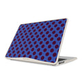 On Pause - Macbook Case