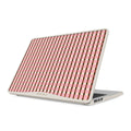Sleeping In - Macbook Case