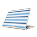 White Noise - Macbook Case