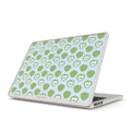 Sweet & Sour - Macbook Case