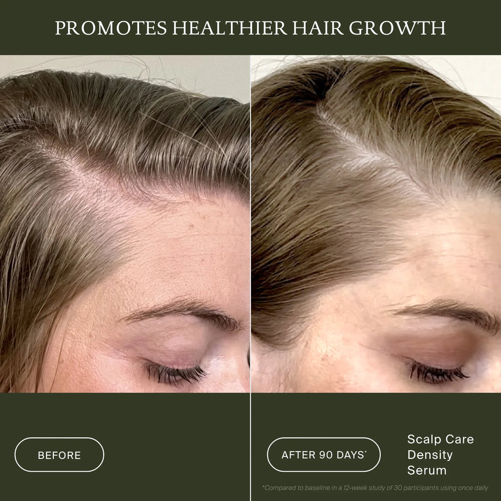 Scalp Care Density Serum