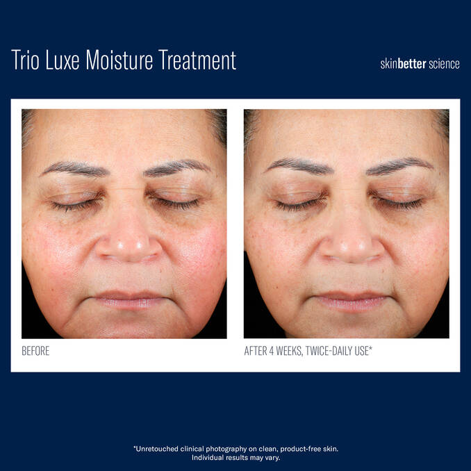 SkinBetter Trio Luxe Moisture Treatment 50ml