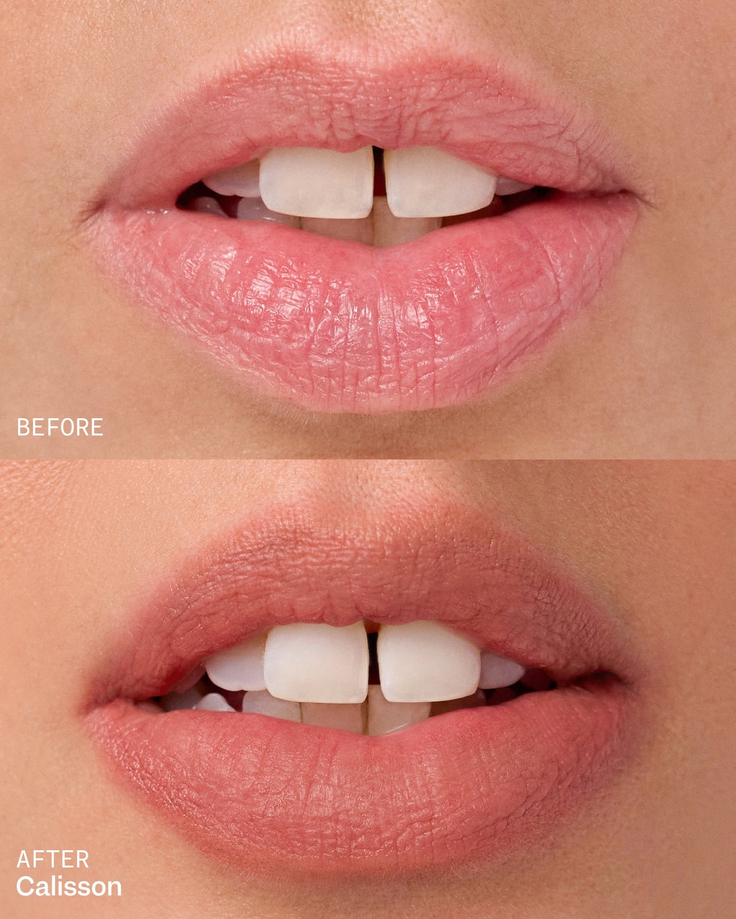 Bisou Balm - Calisson