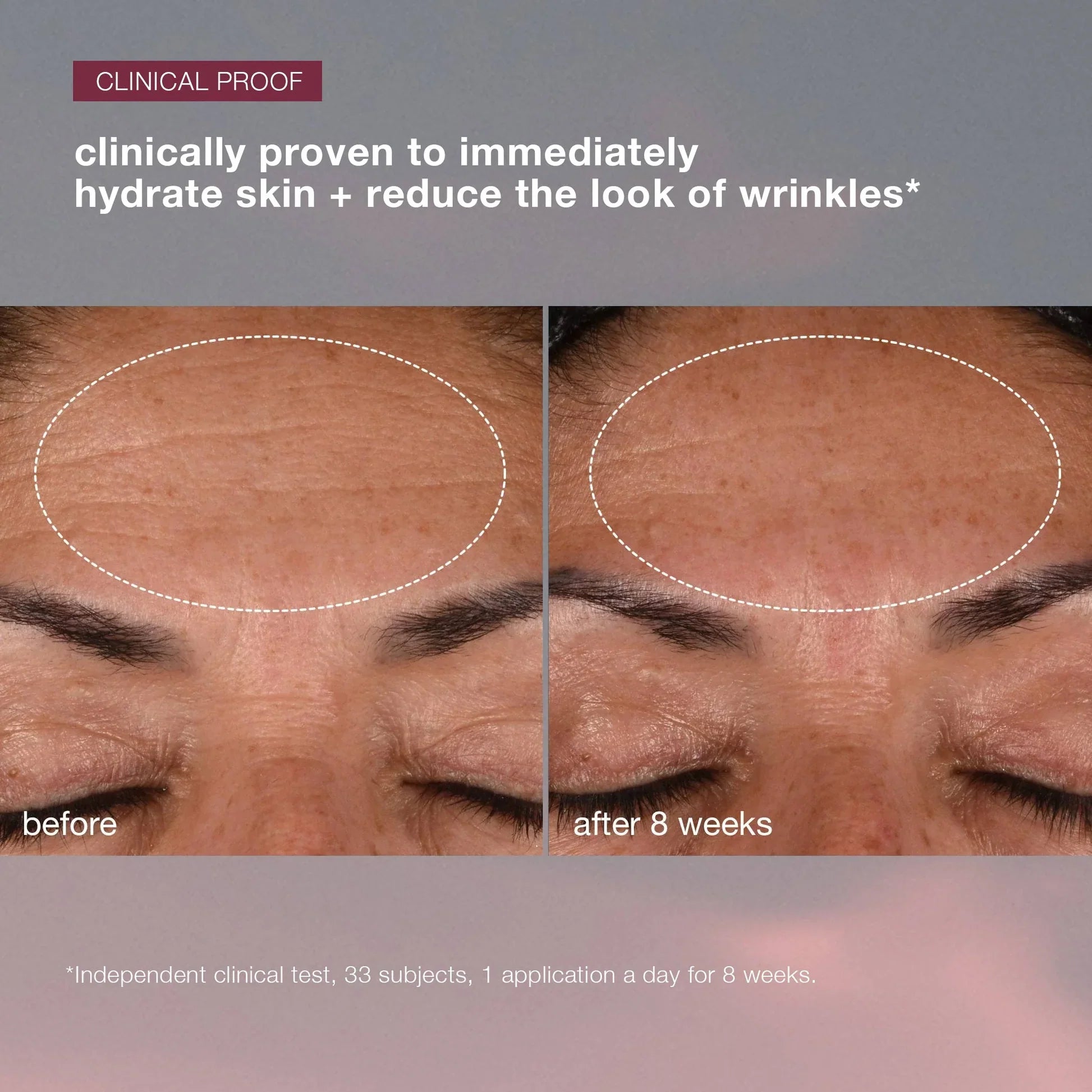 dynamic skin recovery spf 50 moisturizer