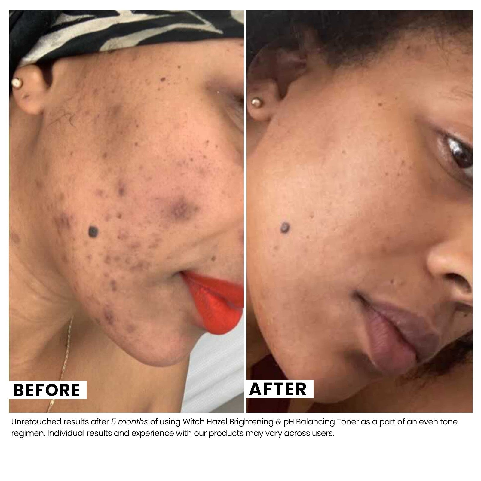 Brightening & pH Balancing Witch Hazel Toner